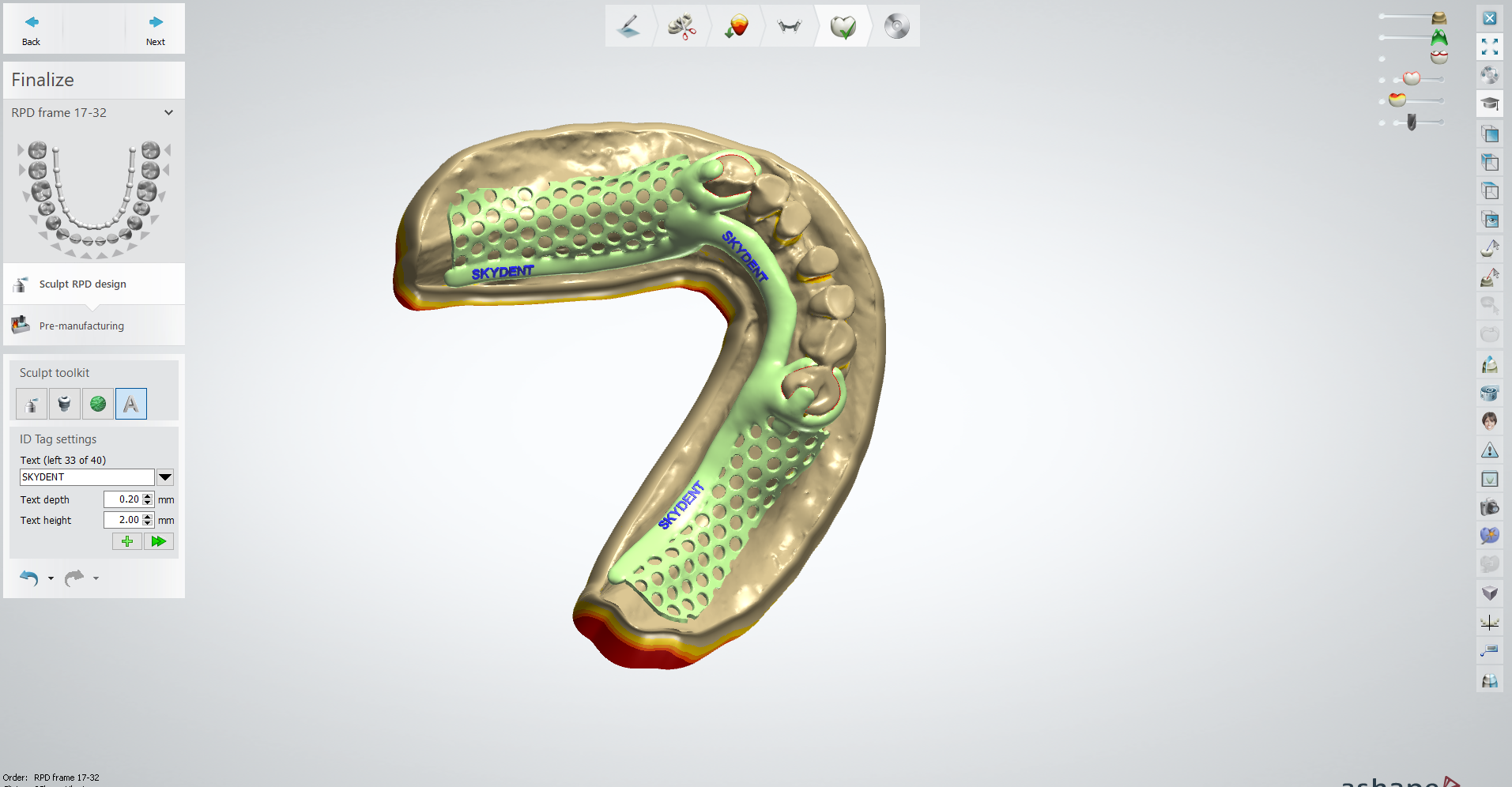 RPD Design Variation